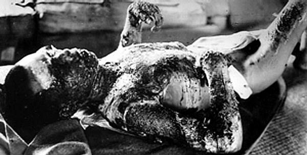 http://www.thehypertexts.com/images/hiroshima%20victim09.jpg