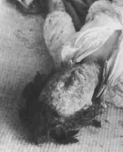 hiroshimaVictim30312219280994100.jpeg